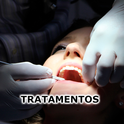 Imagem ilustrativa tratamentos Odontologia Koza
