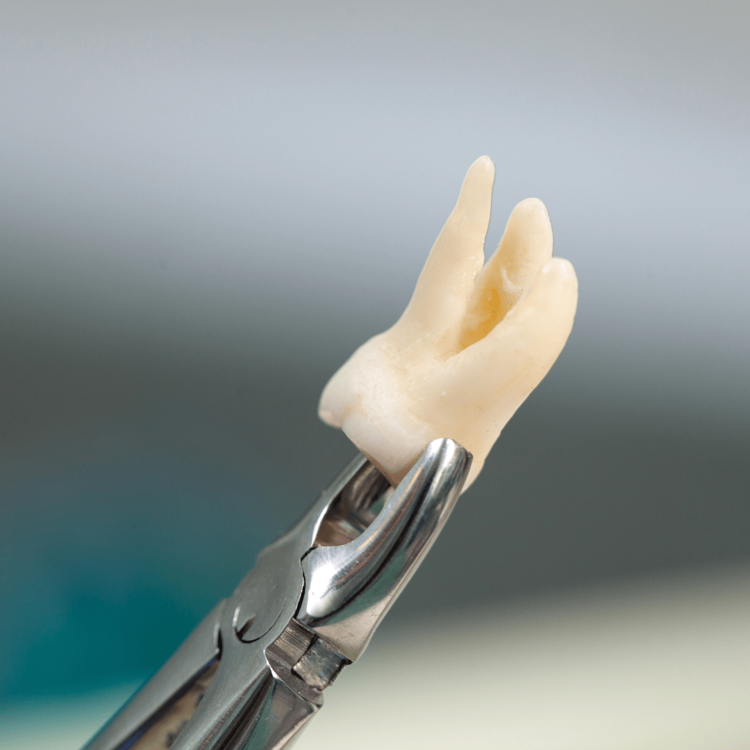 Extrações Dentárias na Odontologia Koza